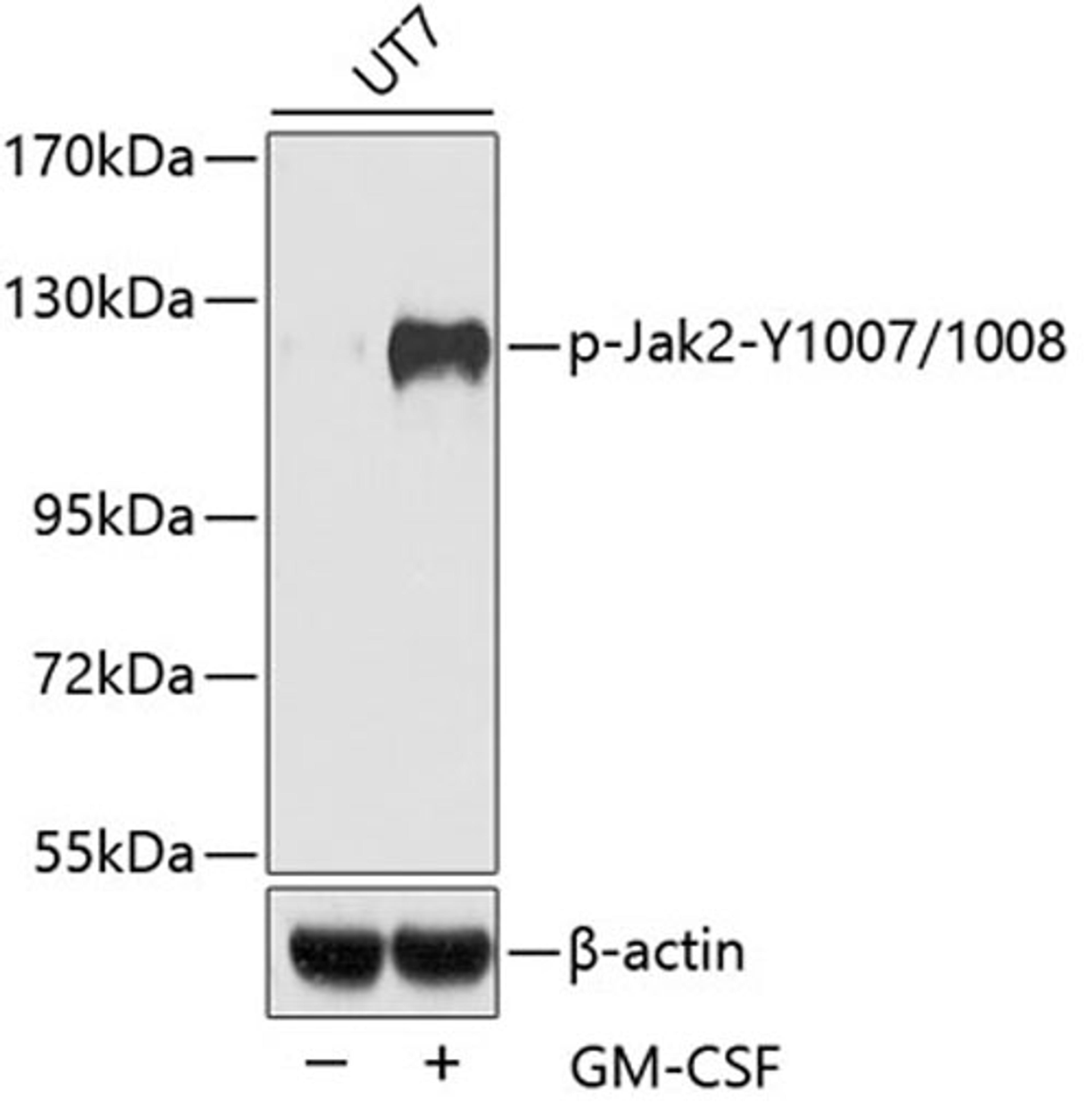 Western blot - Phospho-Jak2-Y1007/1008 antibody (AP0531)