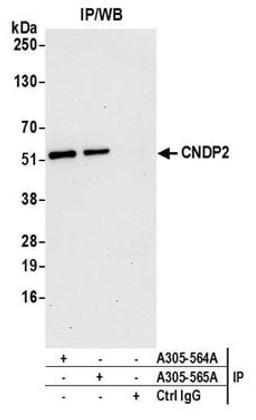 Detection of human CNDP2 by western blot of immunoprecipitates.