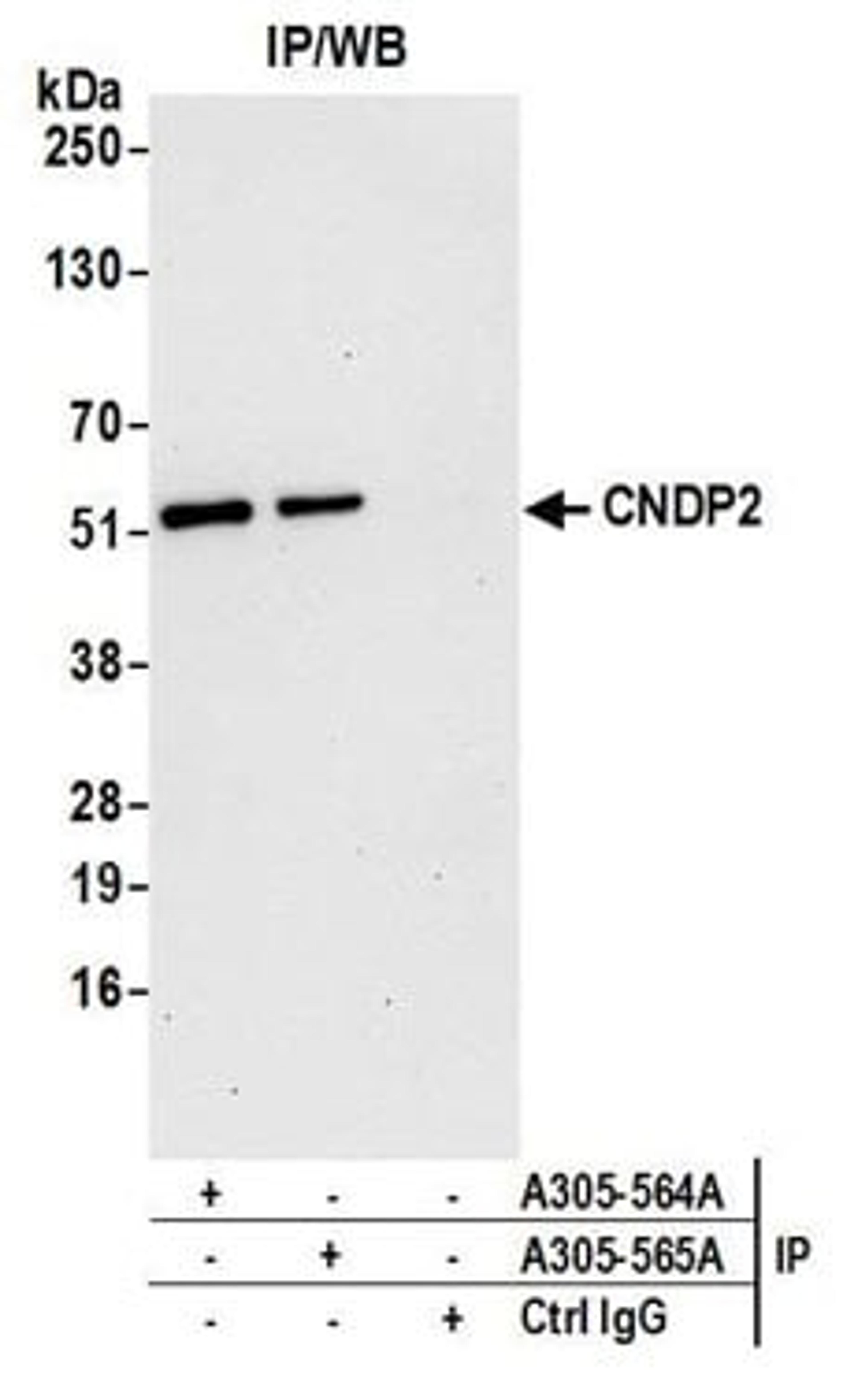 Detection of human CNDP2 by western blot of immunoprecipitates.