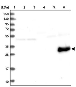 Western Blot: myozenin 3 Antibody [NBP1-90616] - Lane 1: Marker [kDa] 250, 130, 95, 72, 55, 36, 28, 17, 10<br/>Lane 2: Human cell line RT-4<br/>Lane 3: Human cell line U-251MG sp<br/>Lane 4: Human plasma (IgG/HSA depleted)<br/>Lane 5: Human liver tissue<br/>Lane 6: Human tonsil tissue