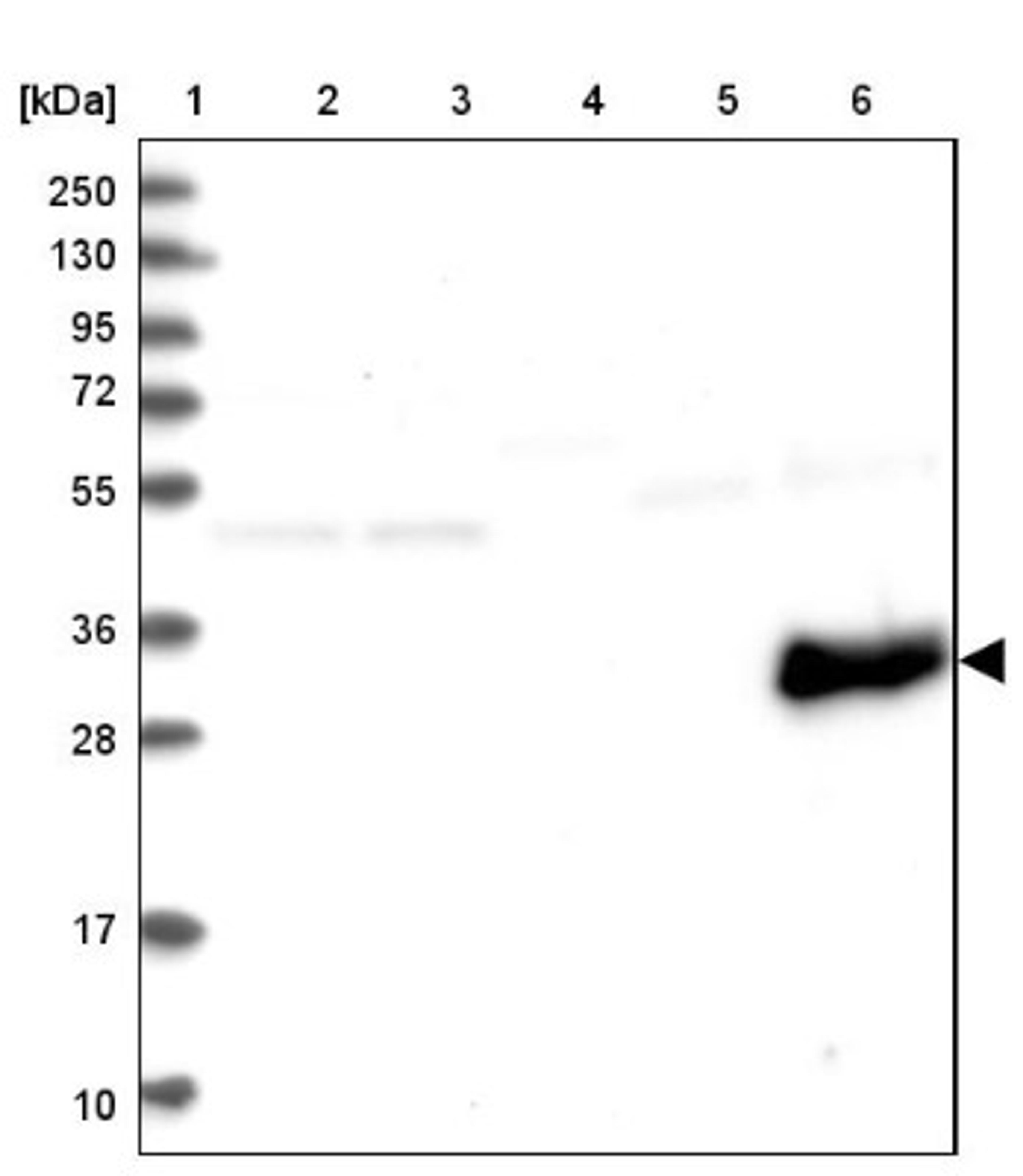 Western Blot: myozenin 3 Antibody [NBP1-90616] - Lane 1: Marker [kDa] 250, 130, 95, 72, 55, 36, 28, 17, 10<br/>Lane 2: Human cell line RT-4<br/>Lane 3: Human cell line U-251MG sp<br/>Lane 4: Human plasma (IgG/HSA depleted)<br/>Lane 5: Human liver tissue<br/>Lane 6: Human tonsil tissue