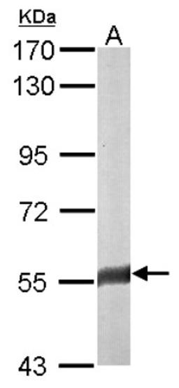 Western Blot: FAM126A Antibody [NBP1-32914] - Sample (50 ug of whole cell lysate) A: mouse brain 7. 5% SDS PAGE, antibody diluted at 1:3000.