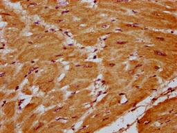 IHC image of CSB-PA810274LA01HU diluted at 1:400 and staining in paraffin-embedded human heart tissue performed on a Leica BondTM system. After dewaxing and hydration, antigen retrieval was mediated by high pressure in a citrate buffer (pH 6.0). Section was blocked with 10% normal goat serum 30min at RT. Then primary antibody (1% BSA) was incubated at 4°C overnight. The primary is detected by a biotinylated secondary antibody and visualized using an HRP conjugated SP system.
