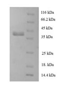 (Tris-Glycine gel) Discontinuous SDS-PAGE (reduced) with 5% enrichment gel and 15% separation gel.