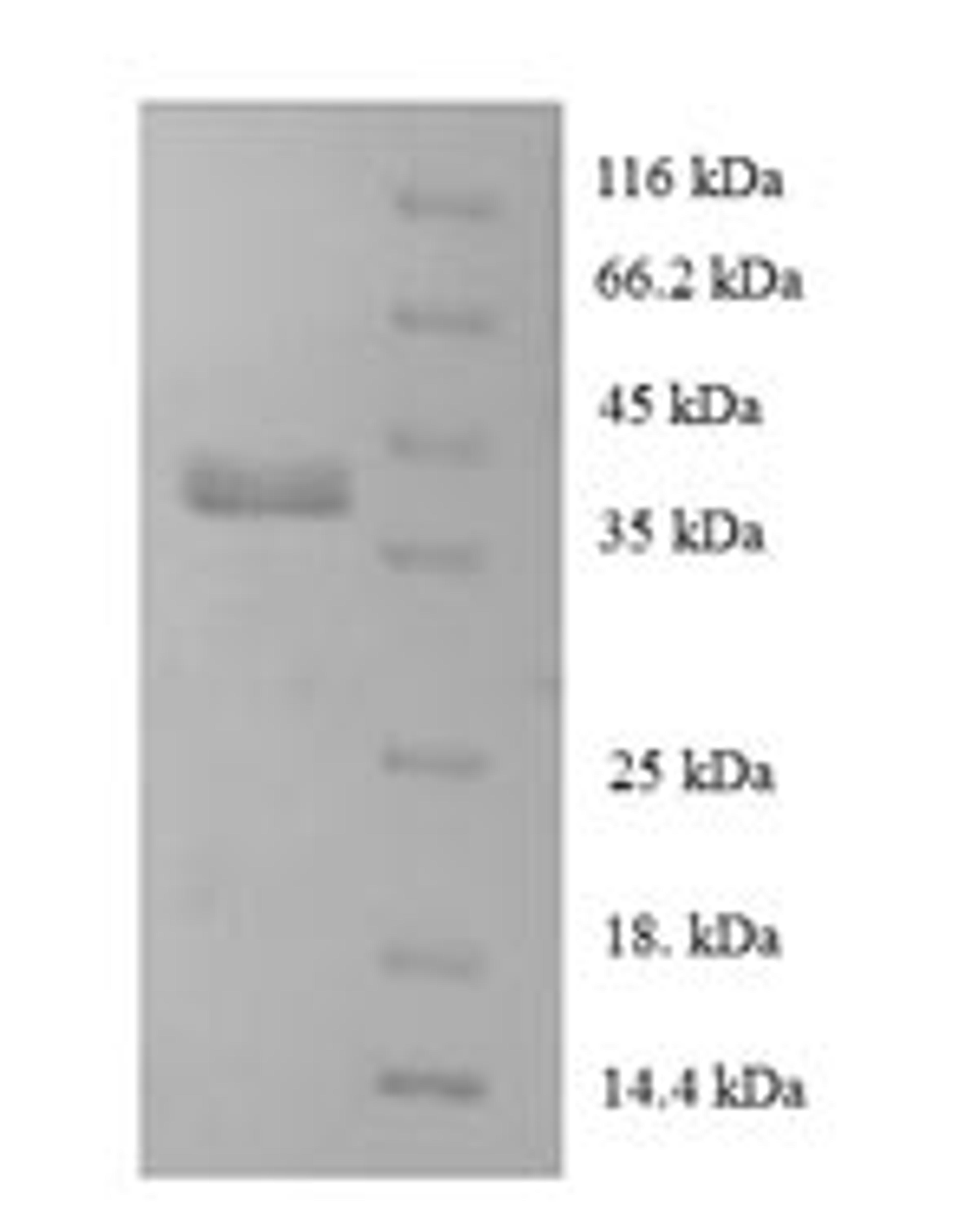 (Tris-Glycine gel) Discontinuous SDS-PAGE (reduced) with 5% enrichment gel and 15% separation gel.