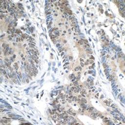 Detection of human ERCC5/XPG by immunohistochemistry.