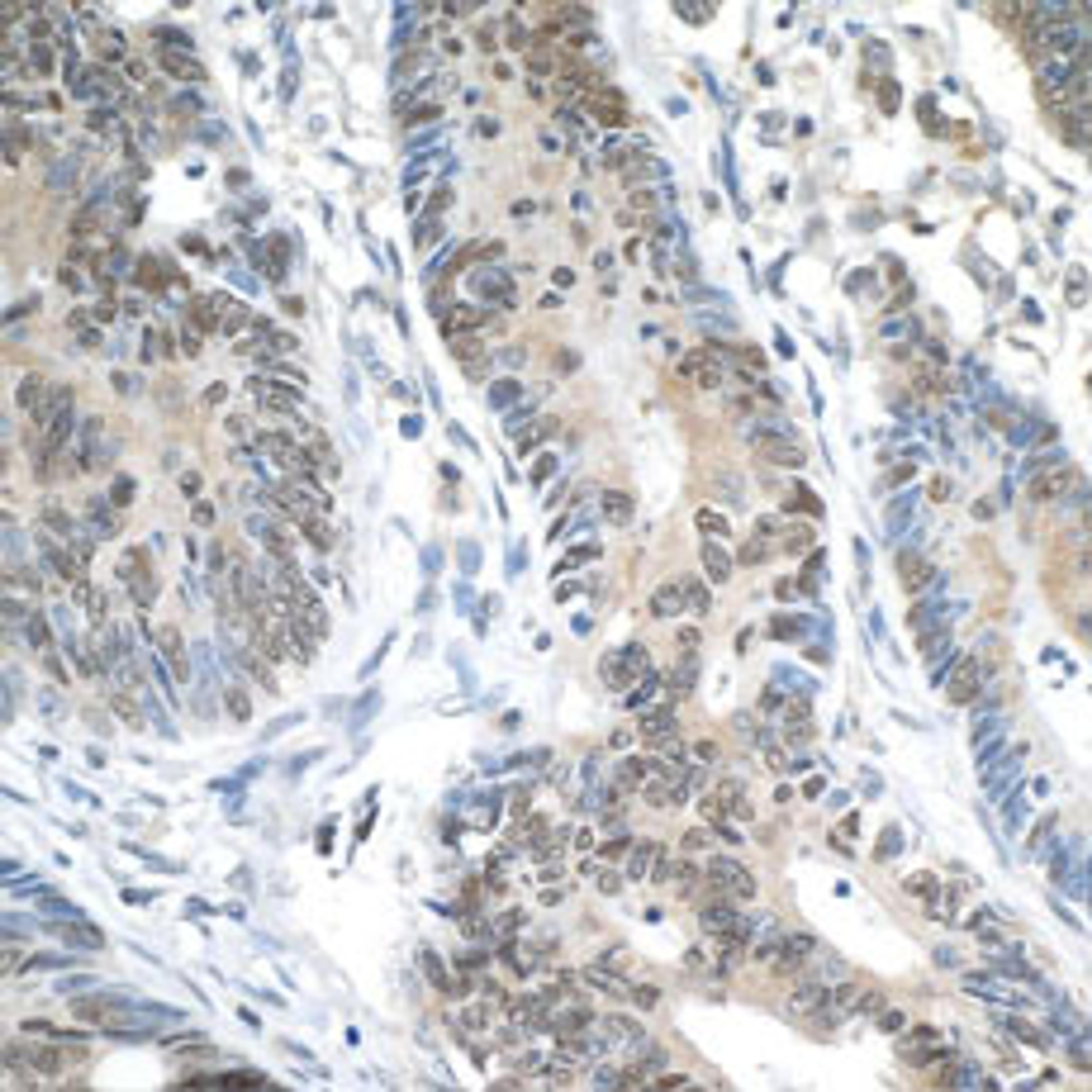 Detection of human ERCC5/XPG by immunohistochemistry.