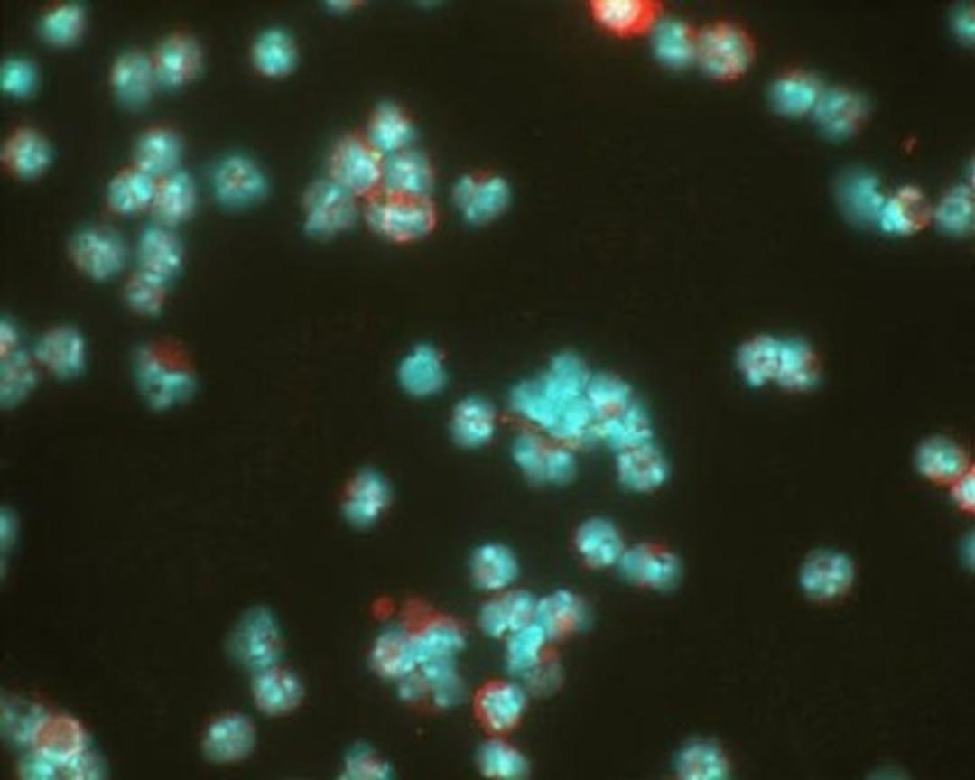 Immunocytochemistry/Immunofluorescence: HIF-1 alpha Antibody (ESEE122) [NB100-131] - Detection of HIF-1 alpha (red dye) in a cell cytospin from a lavage of a murine skin pouch infected with Staph Aureus, using NB100-131. Blue dye is DAPI nuclear staining. Photos courtesy of Susan Alexander and Hattie Gresham, PhD.