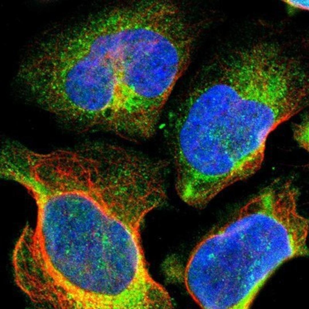 Immunocytochemistry/Immunofluorescence: DNAJC1 Antibody [NBP1-85002] - Staining of human cell line U-2 OS shows positivity in endoplasmic reticulum.