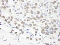 Detection of human Symplekin immunohistochemistry.