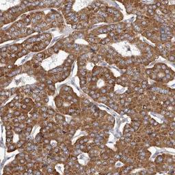 Immunohistochemistry: FMO2 Antibody [NBP1-85952] - Staining of human parathyroid gland shows strong cytoplasmic positivity in glandular cells.