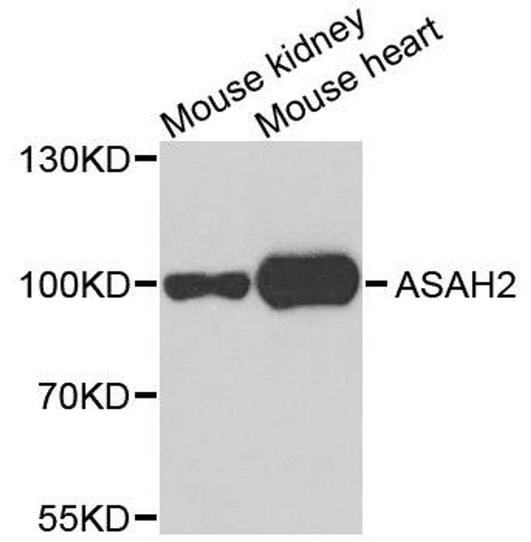 Western blot analysis of extracts of mouse testis using ASAH2 antibody