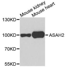 Western blot analysis of extracts of mouse testis using ASAH2 antibody