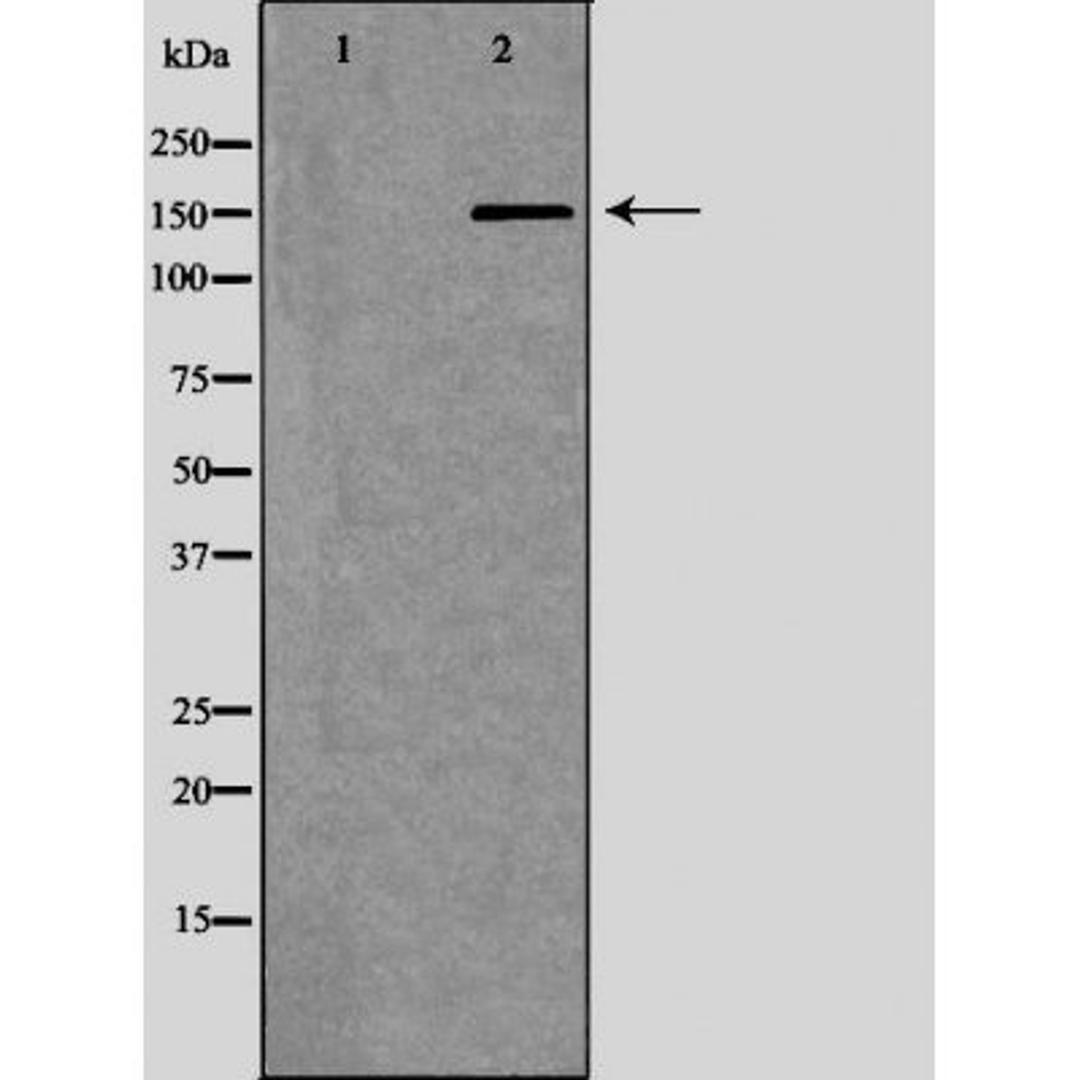 Western blot analysis of testis cell lysate using NCOA1 antibody