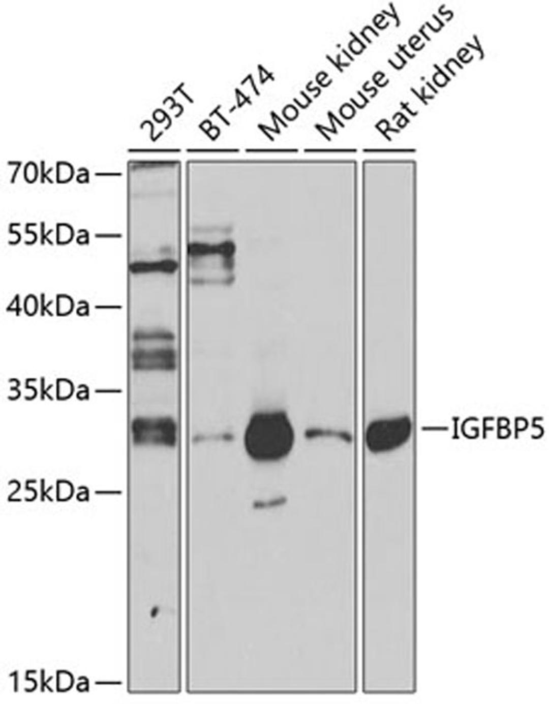 Western blot - IGFBP5 antibody (A12451)