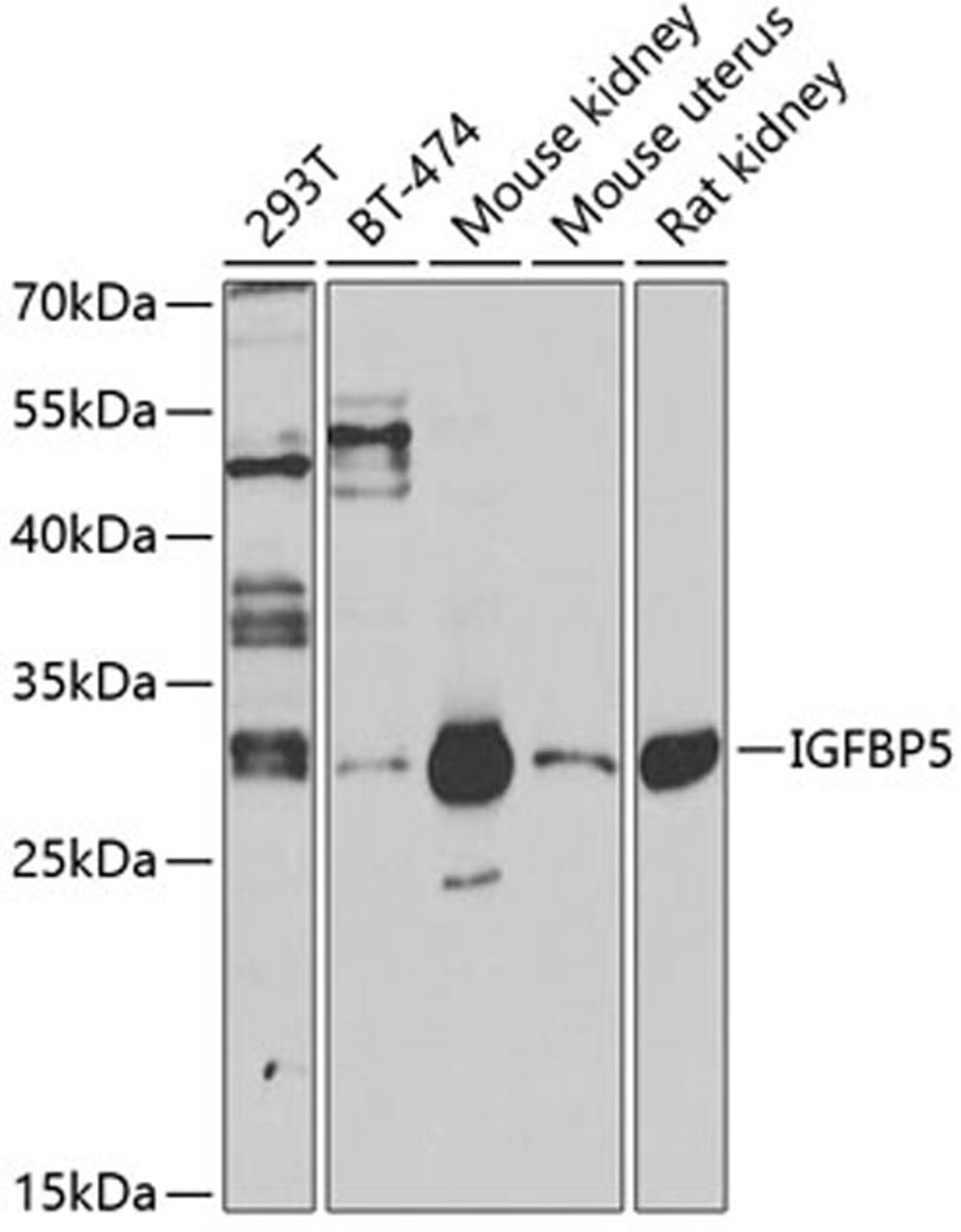 Western blot - IGFBP5 antibody (A12451)