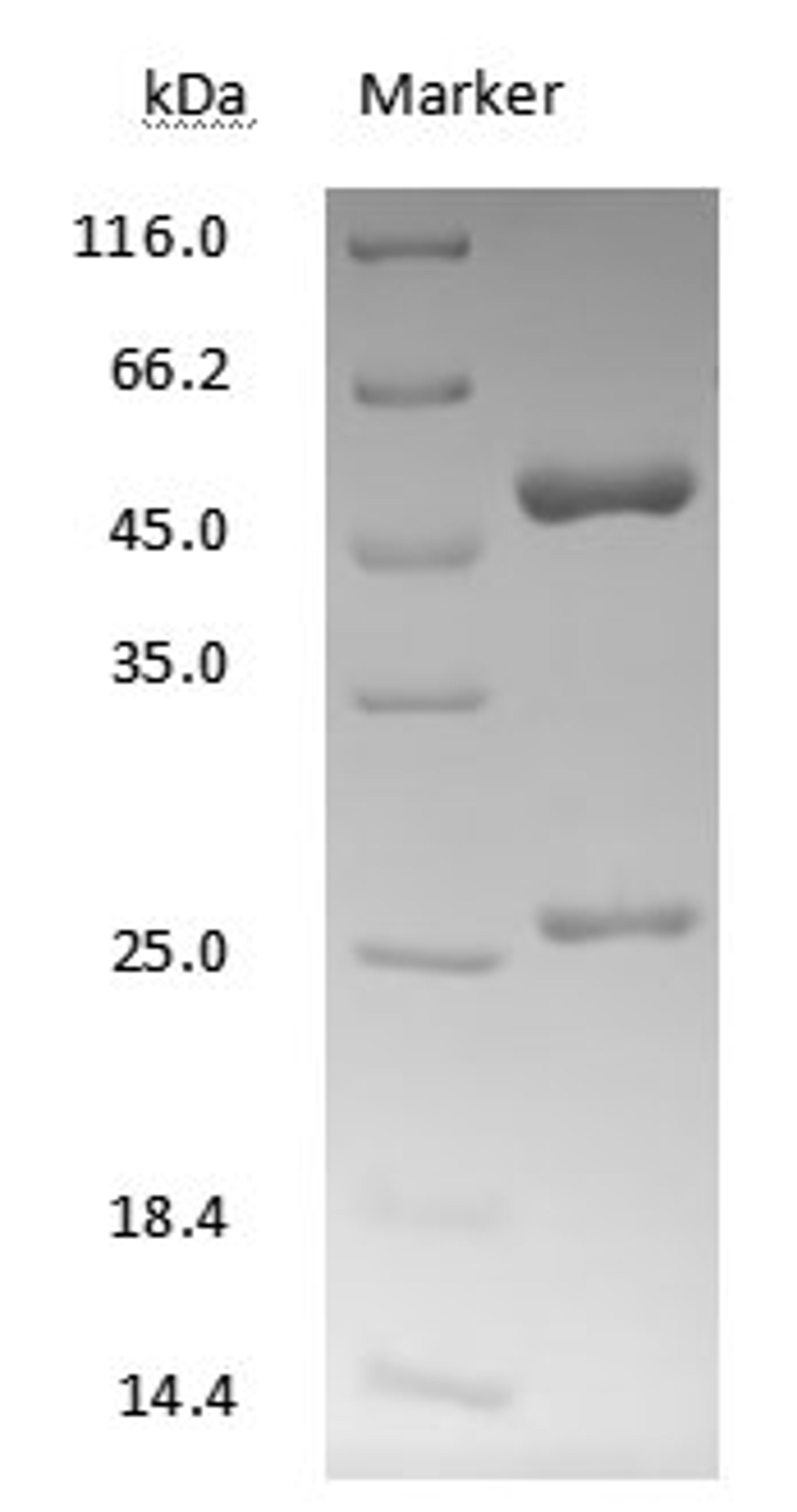 SN38 antibody on SDS-PAGE under reducing (R) condition. The purity of the protein is greater than 90%.