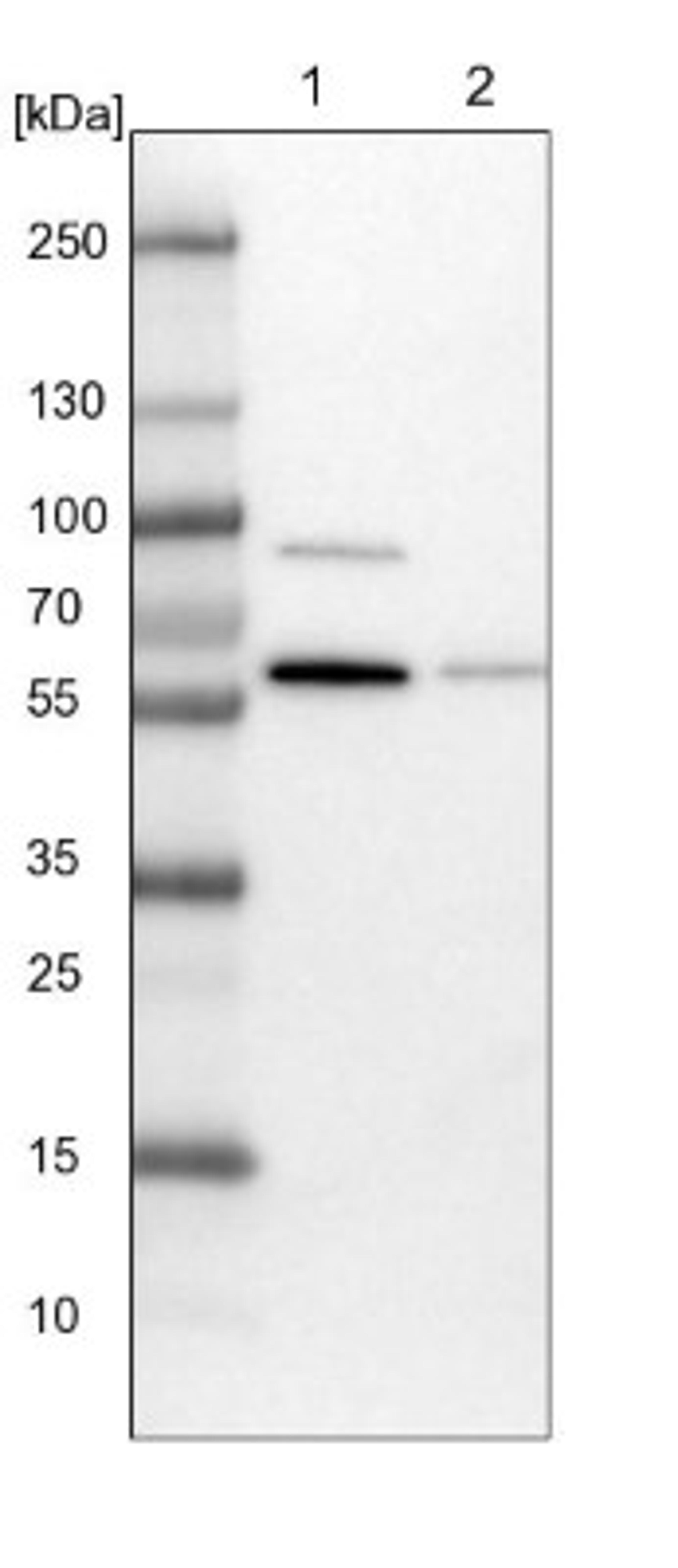 Western Blot: VPS33A Antibody [NBP1-85868] - Lane 1: NIH-3T3 cell lysate (Mouse embryonic fibroblast cells)<br/>Lane 2: NBT-II cell lysate (Rat Wistar bladder tumour cells)