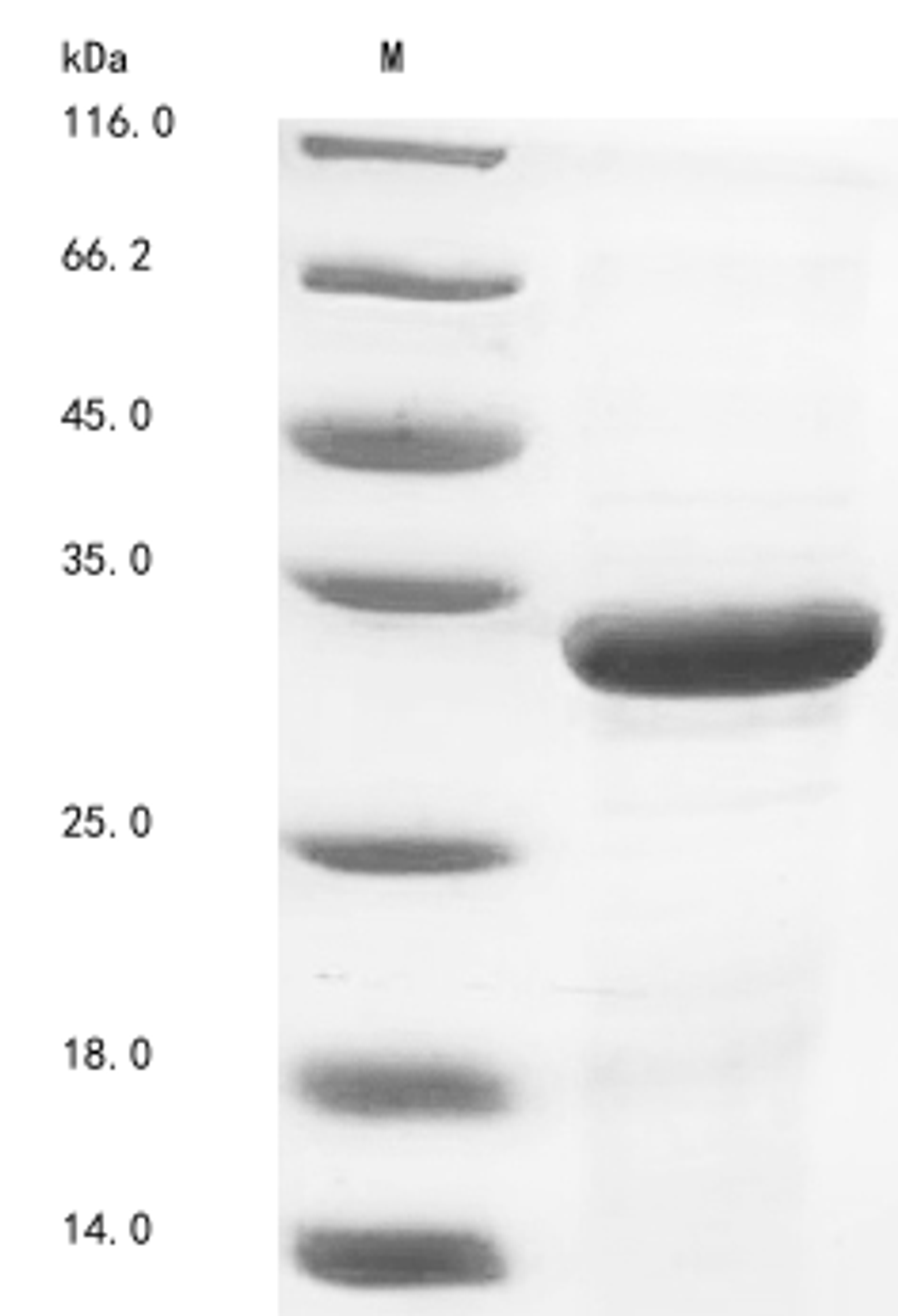 (Tris-Glycine gel) Discontinuous SDS-PAGE (reduced) with 5% enrichment gel and 15% separation gel.
