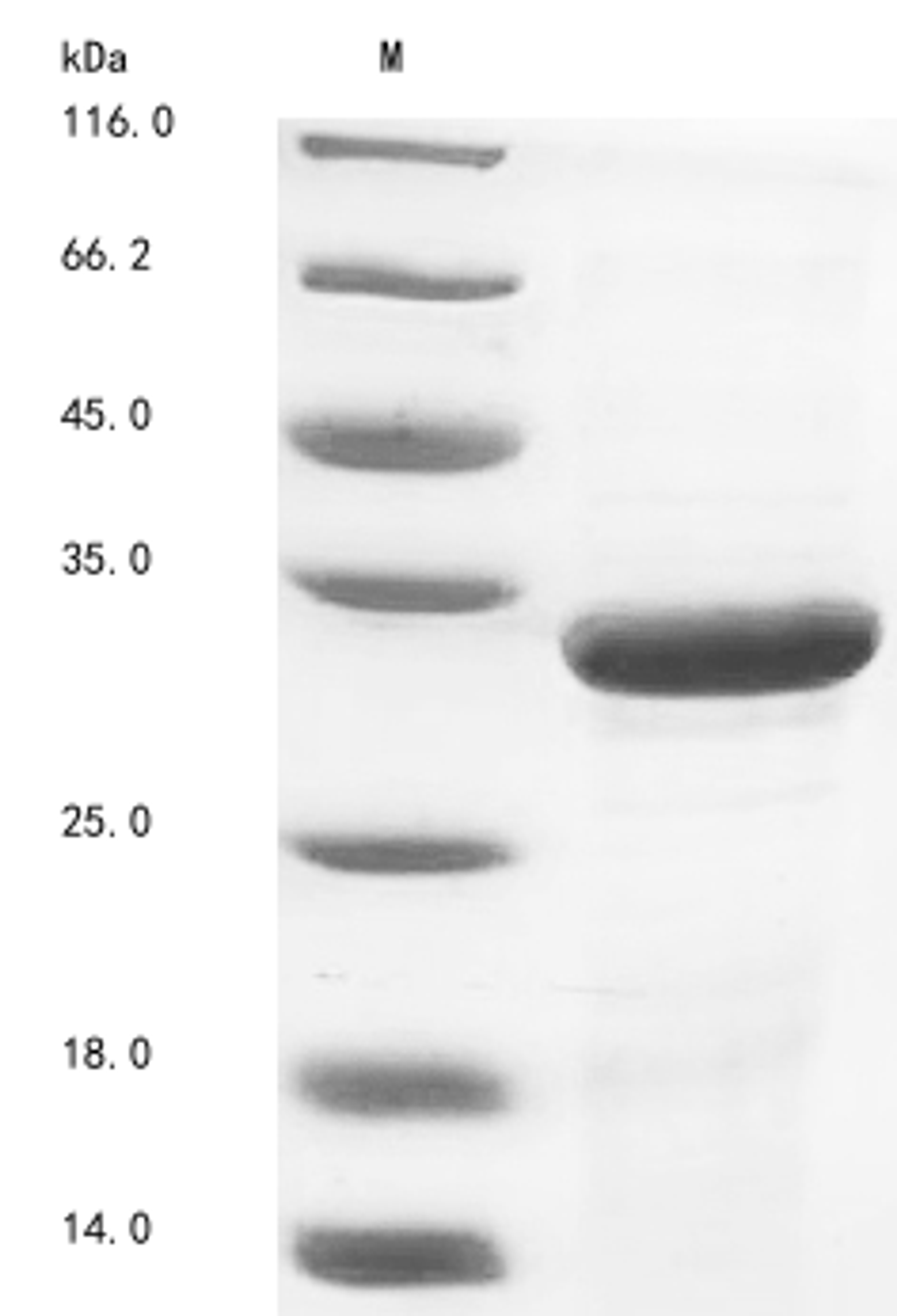 (Tris-Glycine gel) Discontinuous SDS-PAGE (reduced) with 5% enrichment gel and 15% separation gel.