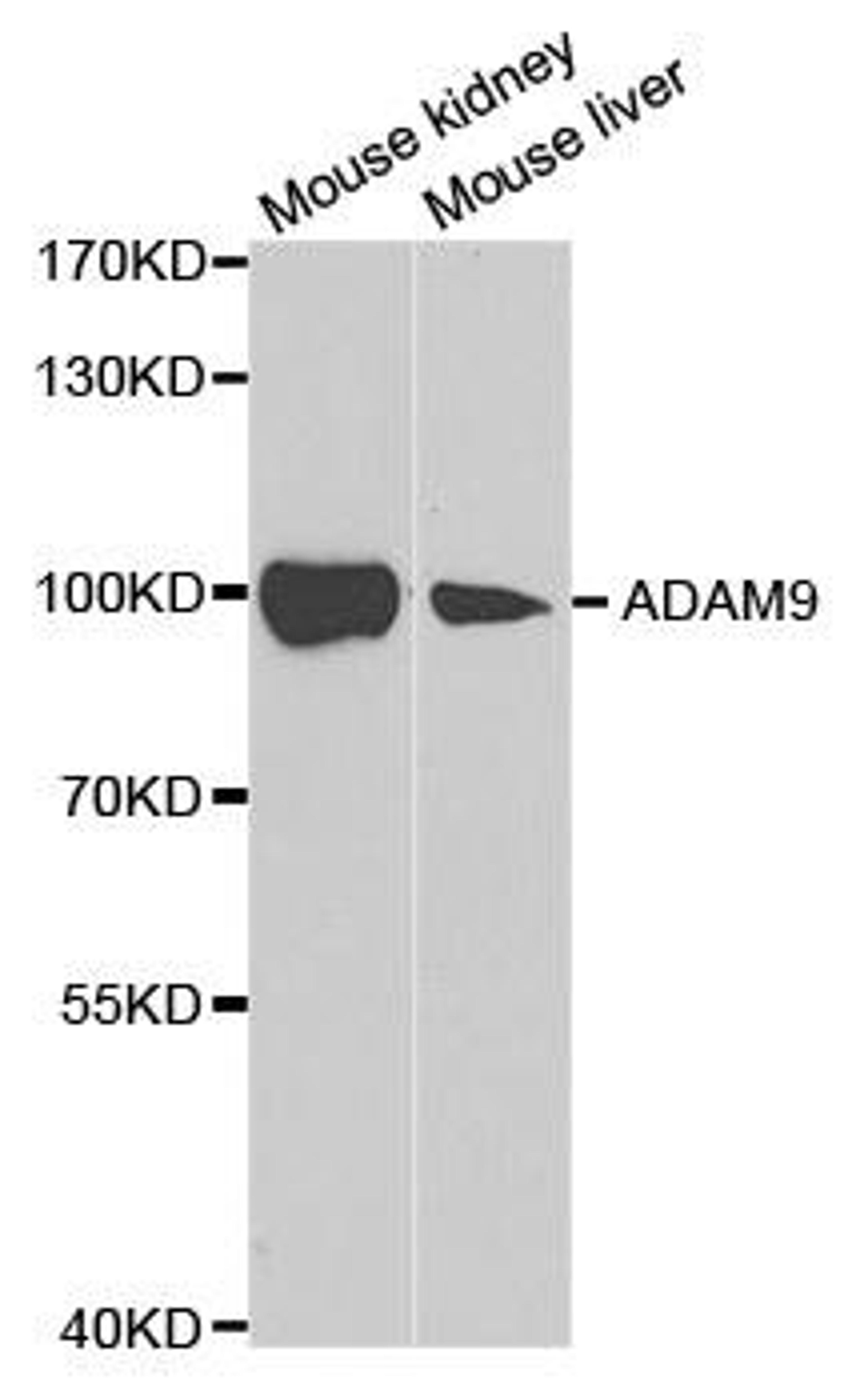 Western blot analysis of extracts of various cell lines using ADAM9 antibody