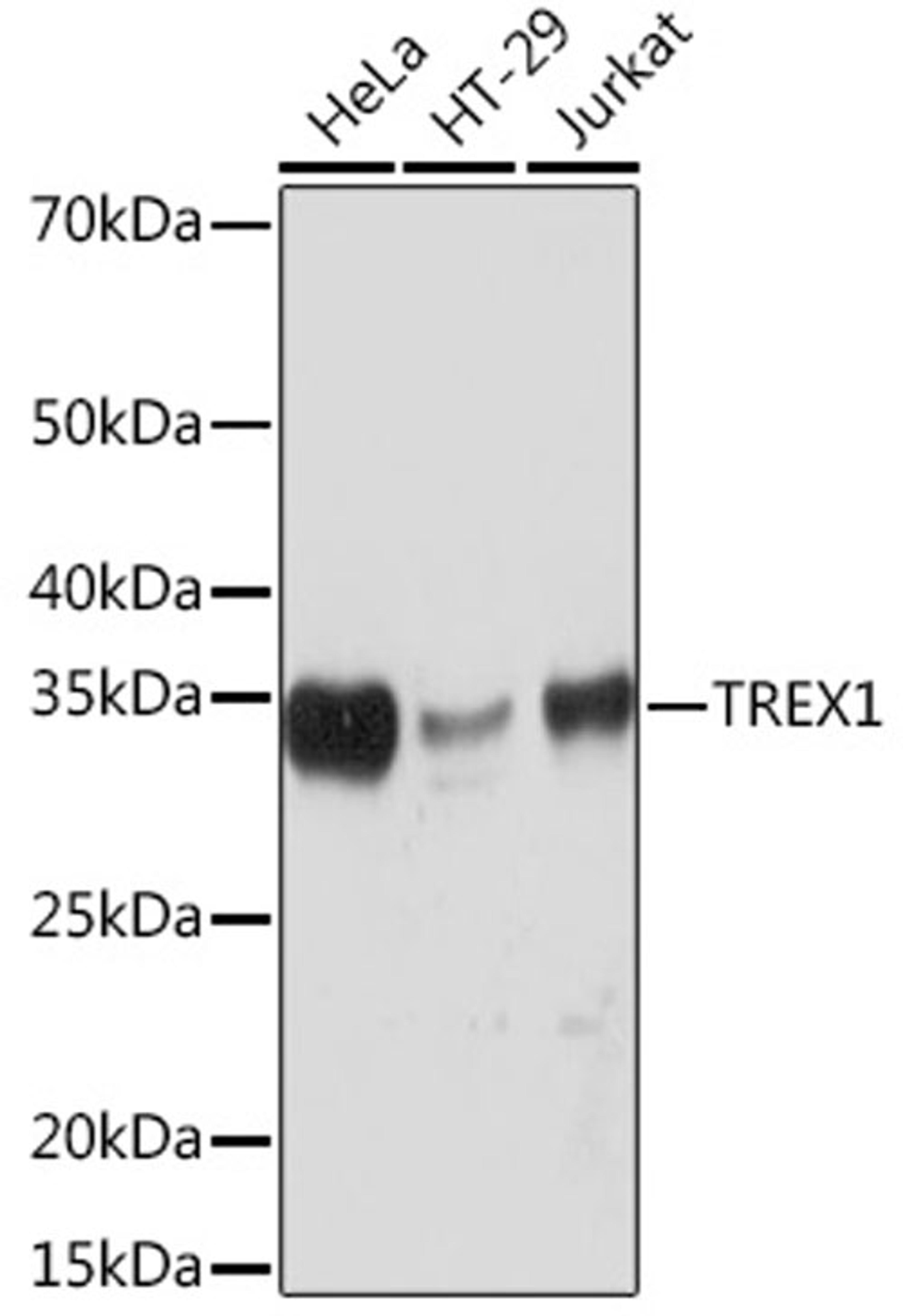 Western blot - TREX1 Rabbit mAb (A3819)