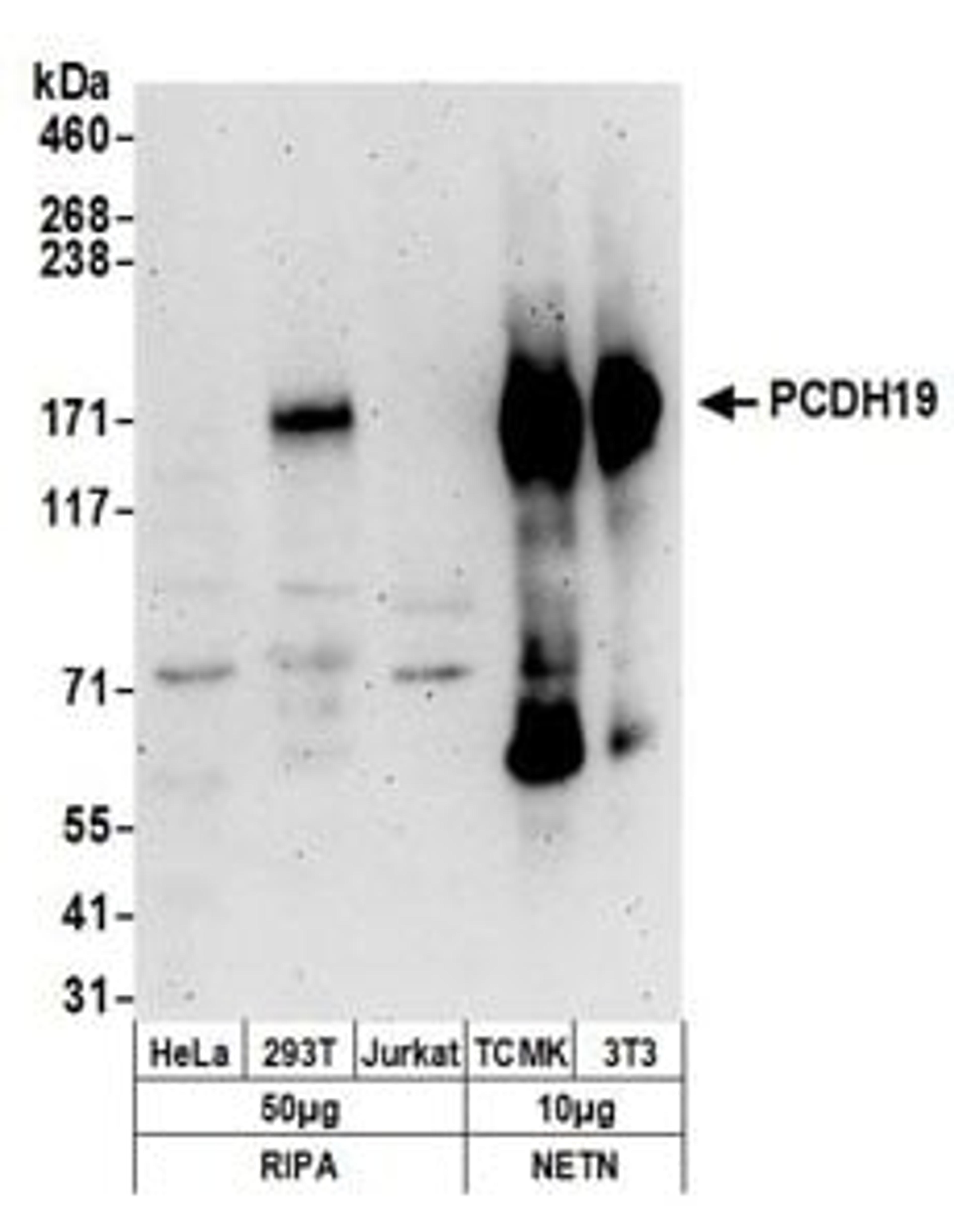 Detection of human and mouse PCDH19 by western blot.