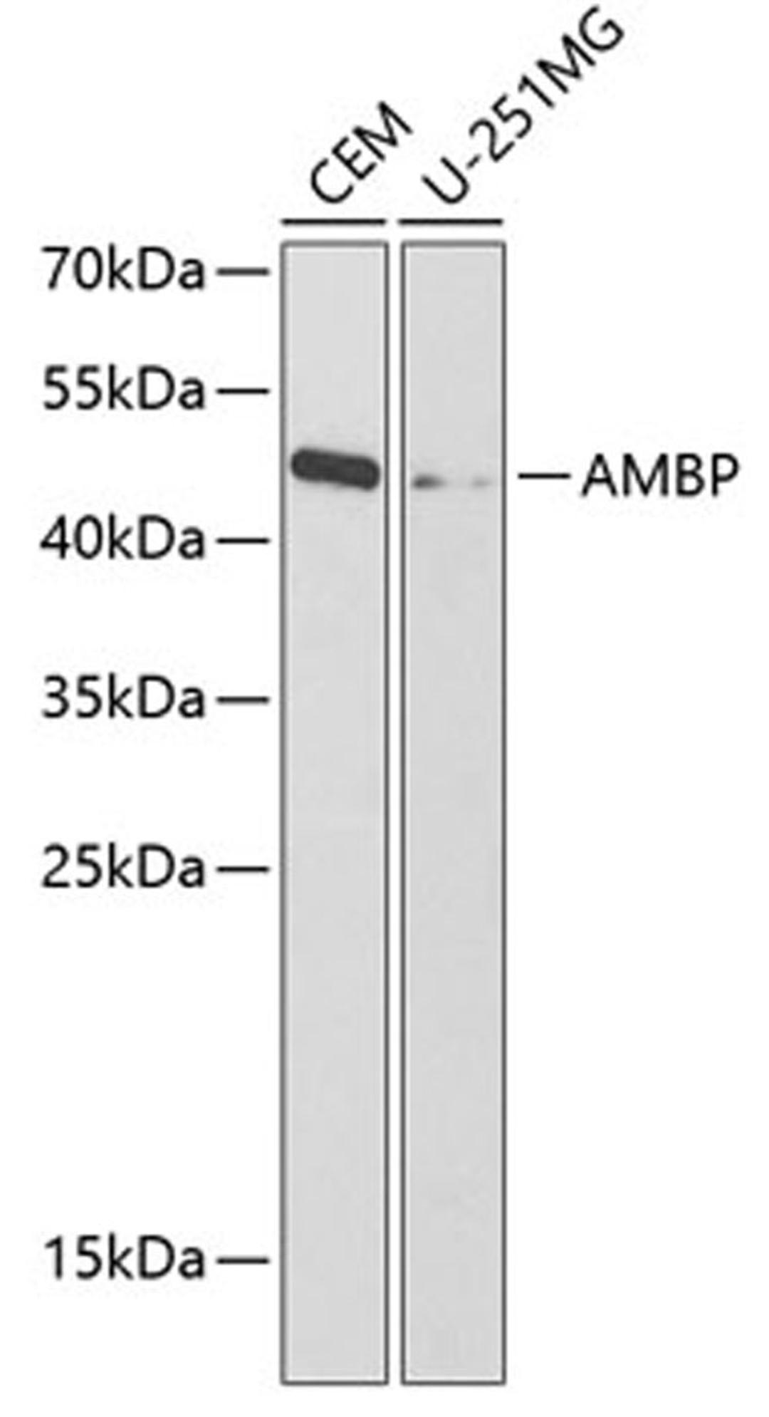 Western blot - AMBP antibody (A1846)