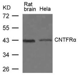 Western blot analysis of lysed extracts from Rat brain tissue and HeLa cells using CNTFRα Antibody.
