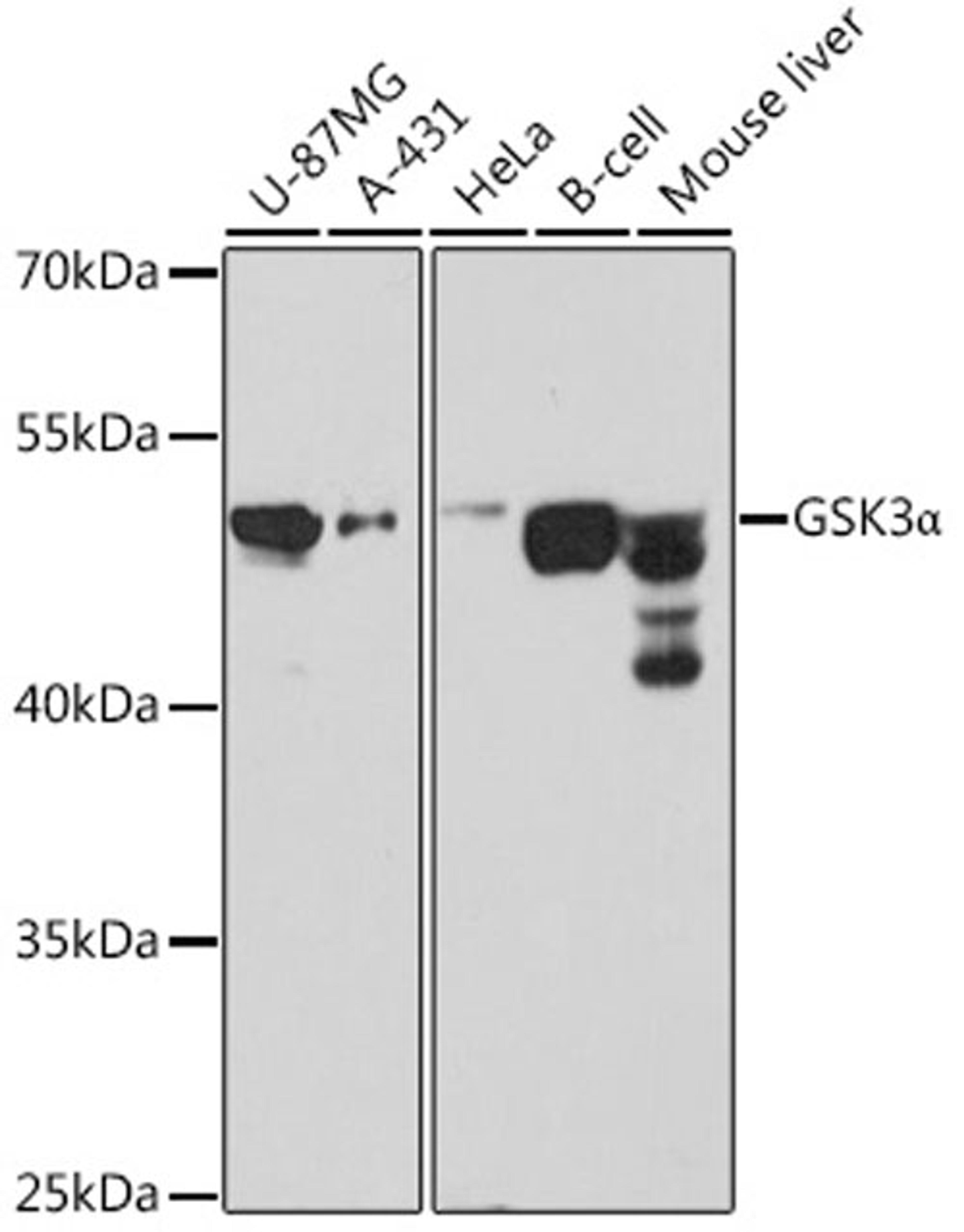 Western blot - GSK3a antibody (A0645)