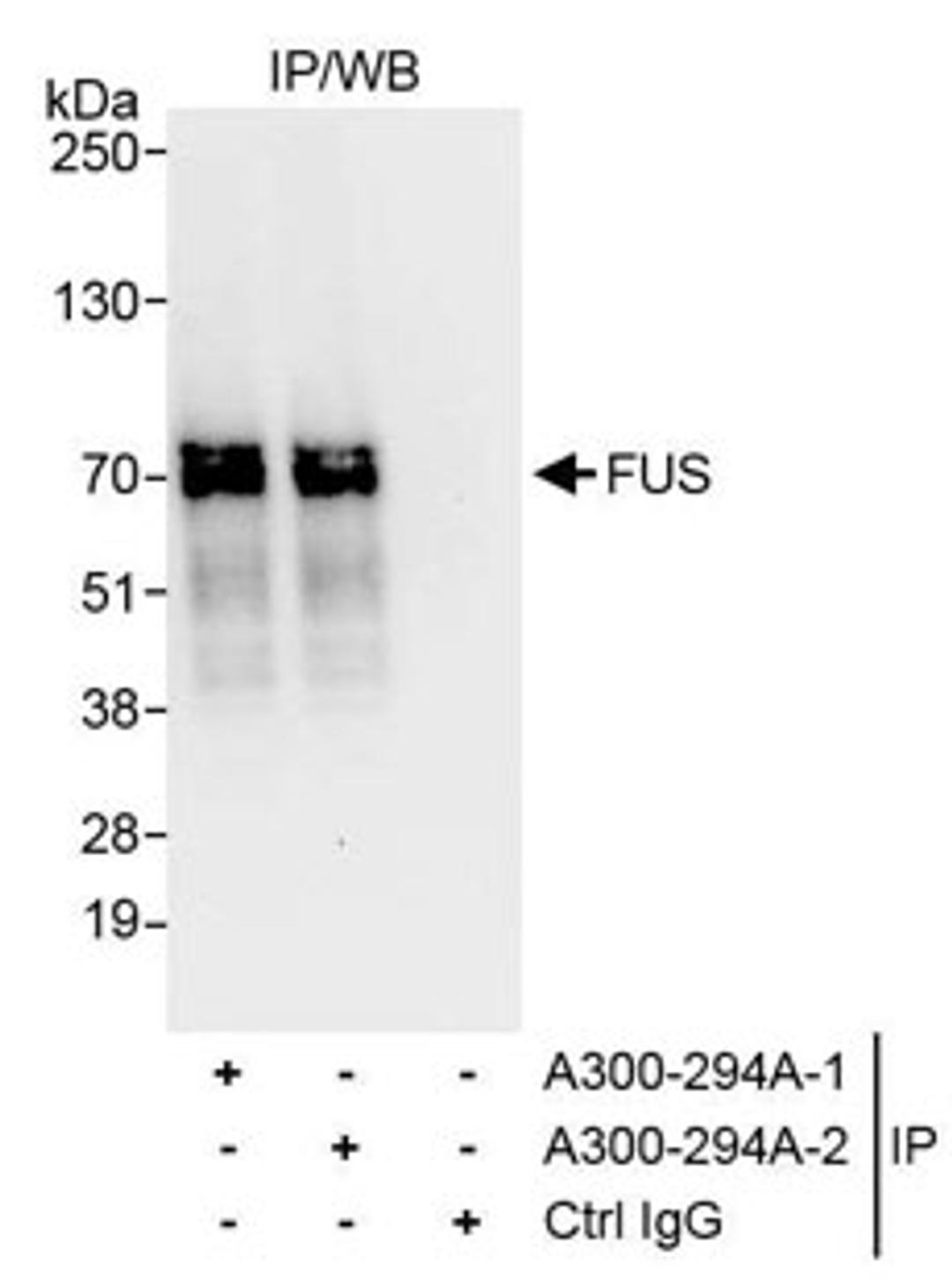 Detection of human FUS by western blot of immunoprecipitates.