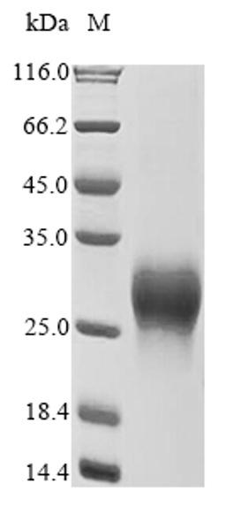 (Tris-Glycine gel) Discontinuous SDS-PAGE (reduced) with 5% enrichment gel and 15% separation gel.