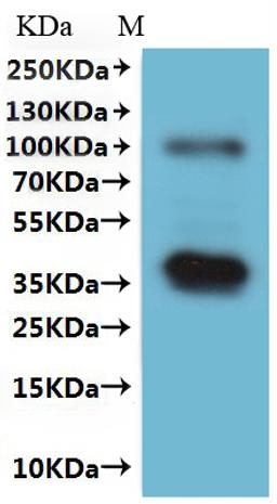 CSB-MP613581HU(A5) is detected by Mouse anti-6*His monoclonal antibody.