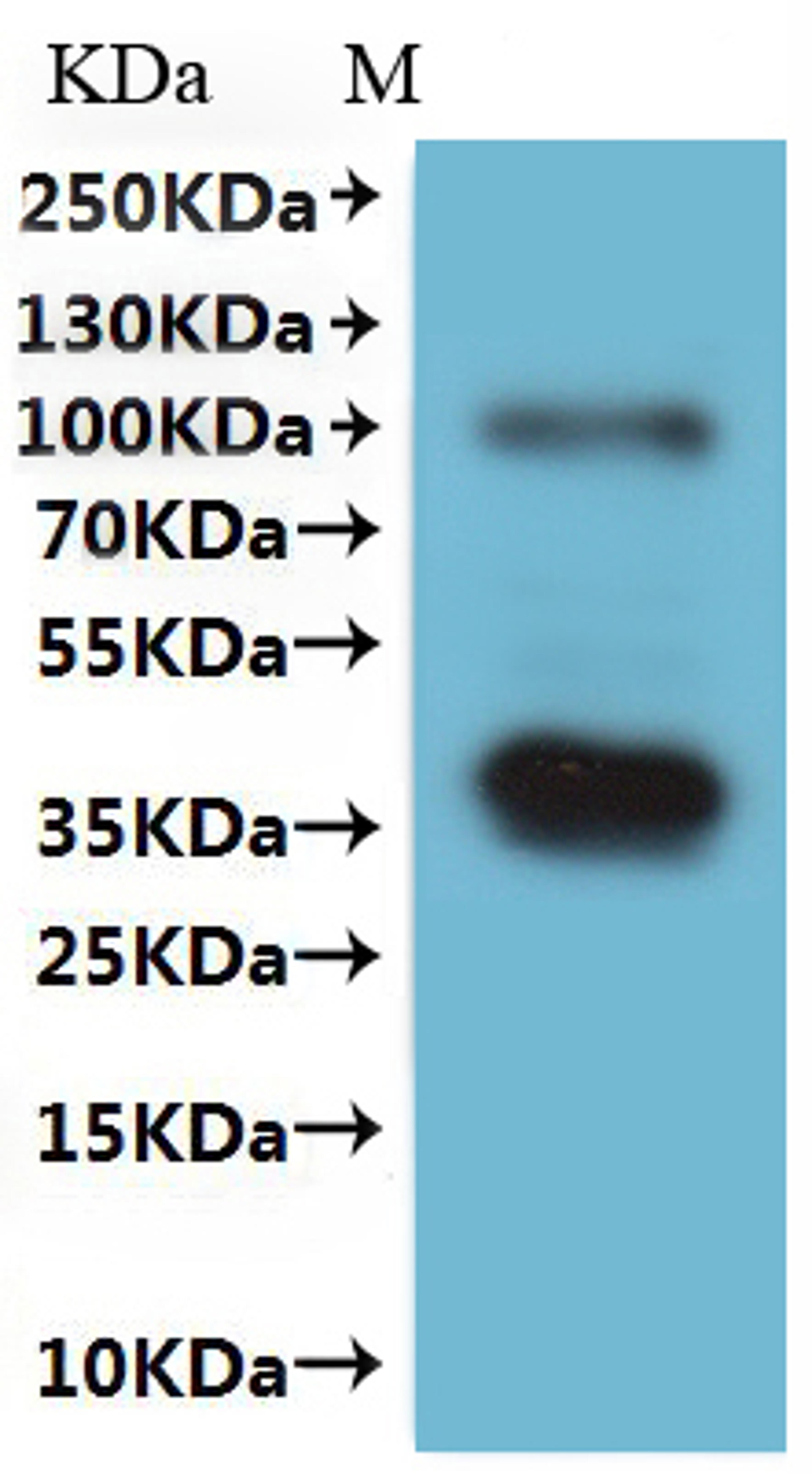 CSB-MP613581HU(A5) is detected by Mouse anti-6*His monoclonal antibody.