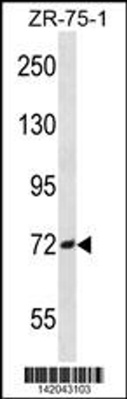 Western blot analysis in ZR-75-1 cell line lysates (35ug/lane).