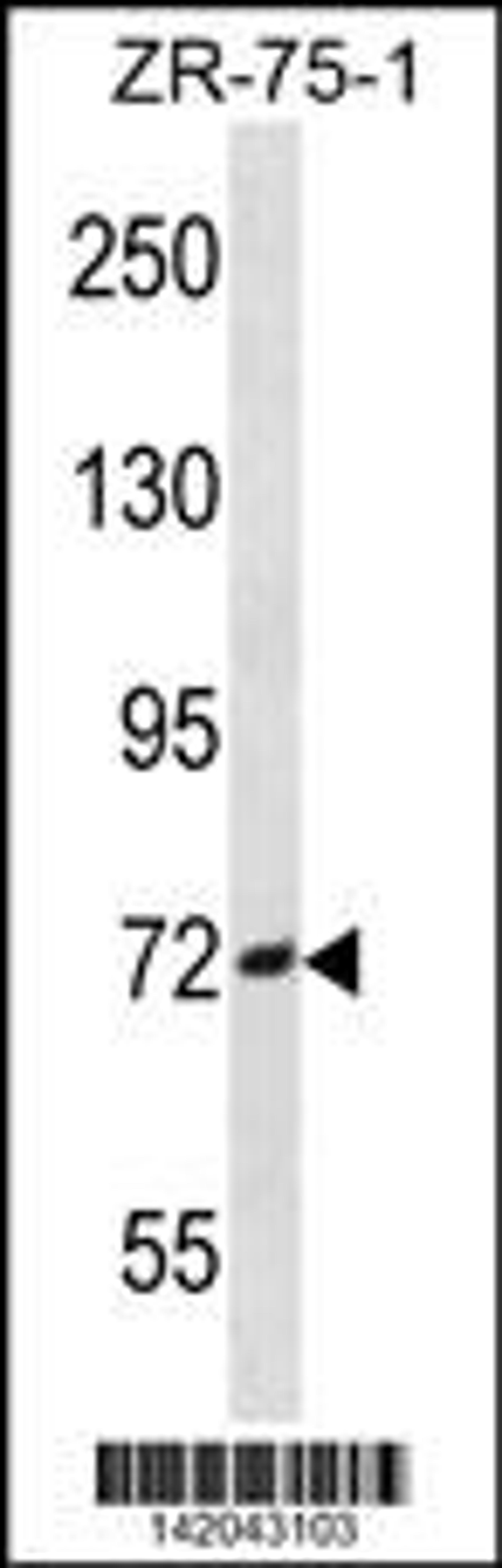 Western blot analysis in ZR-75-1 cell line lysates (35ug/lane).