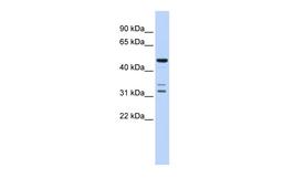 Antibody used in WB on Human Brain at 0.2-1 ug/ml.