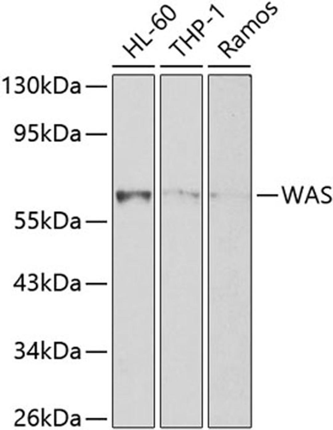 Western blot - WAS Antibody (A0978)