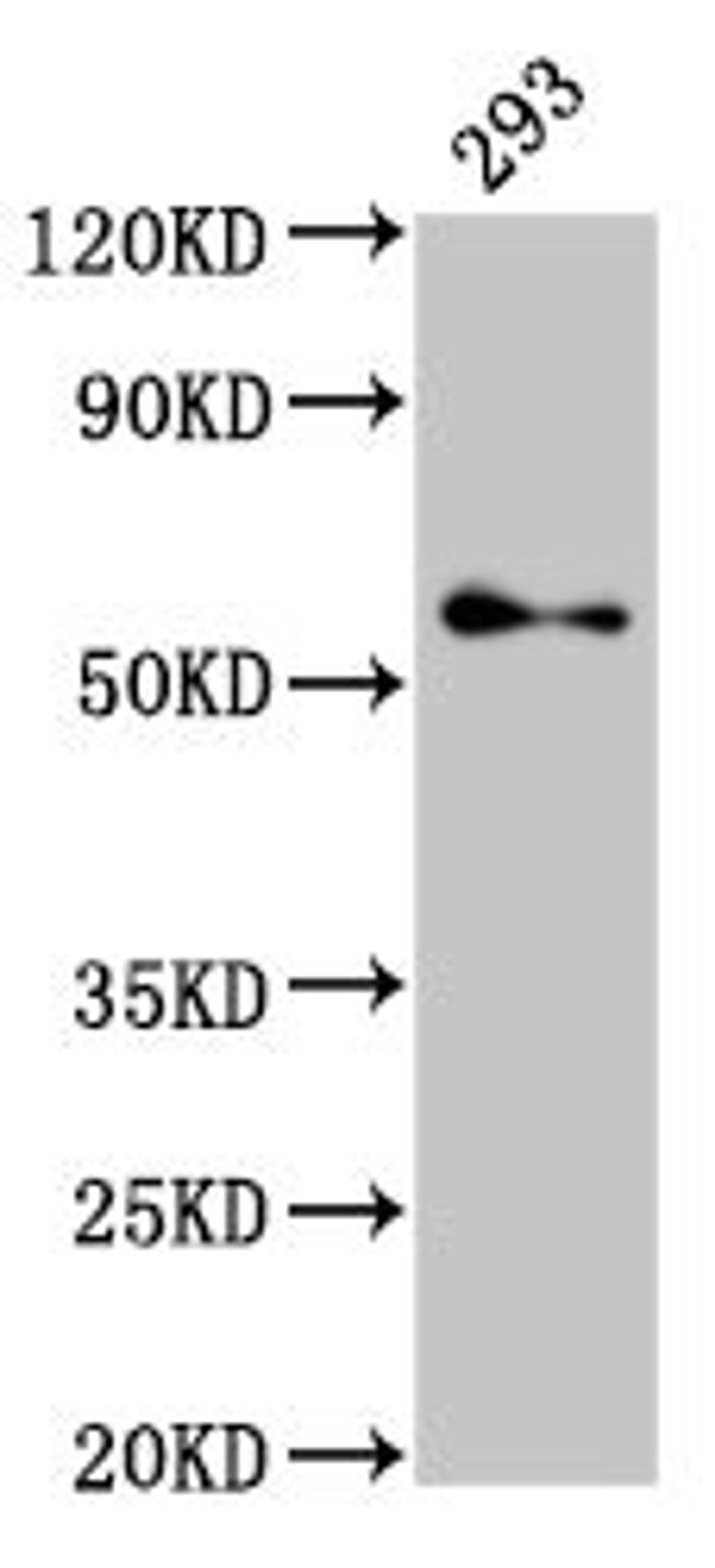 Western Blot. Positive WB detected in: 293 whole cell lysate. All lanes: TFE3 antibody at 2.7µg/ml. Secondary. Goat polyclonal to rabbit IgG at 1/50000 dilution. Predicted band size: 62, 12 kDa. Observed band size: 62 kDa