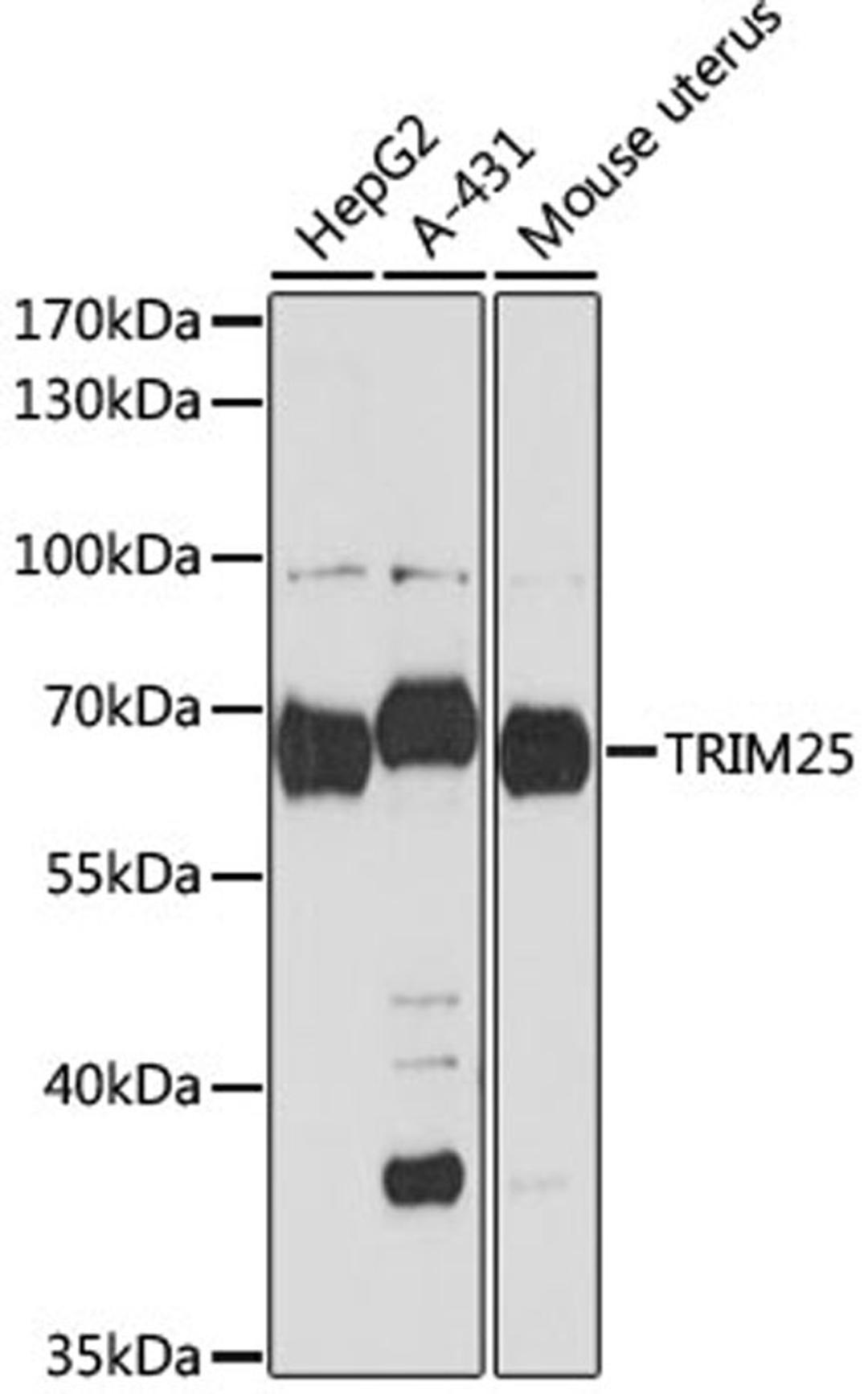 Western blot - TRIM25 antibody (A12938)