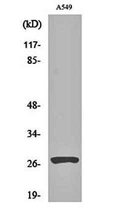 Western blot analysis of A549 cell lysates using Cleaved-Cathepsin D HC (L169) antibody