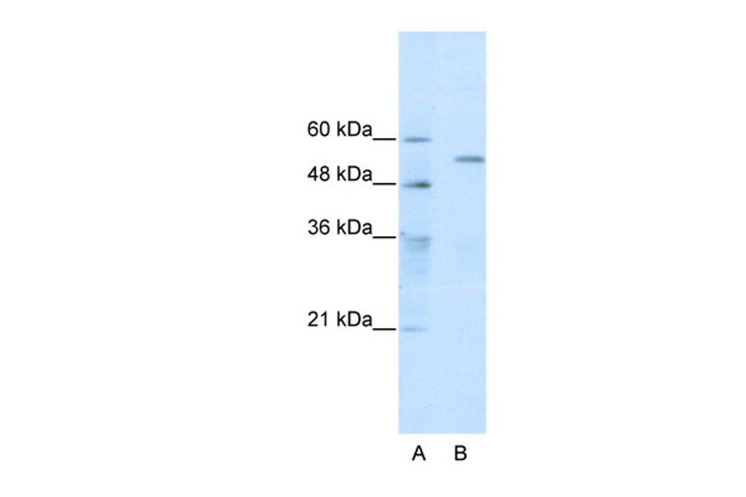 Antibody used in WB on Human HepG2 at 0.2-1 ug/ml.