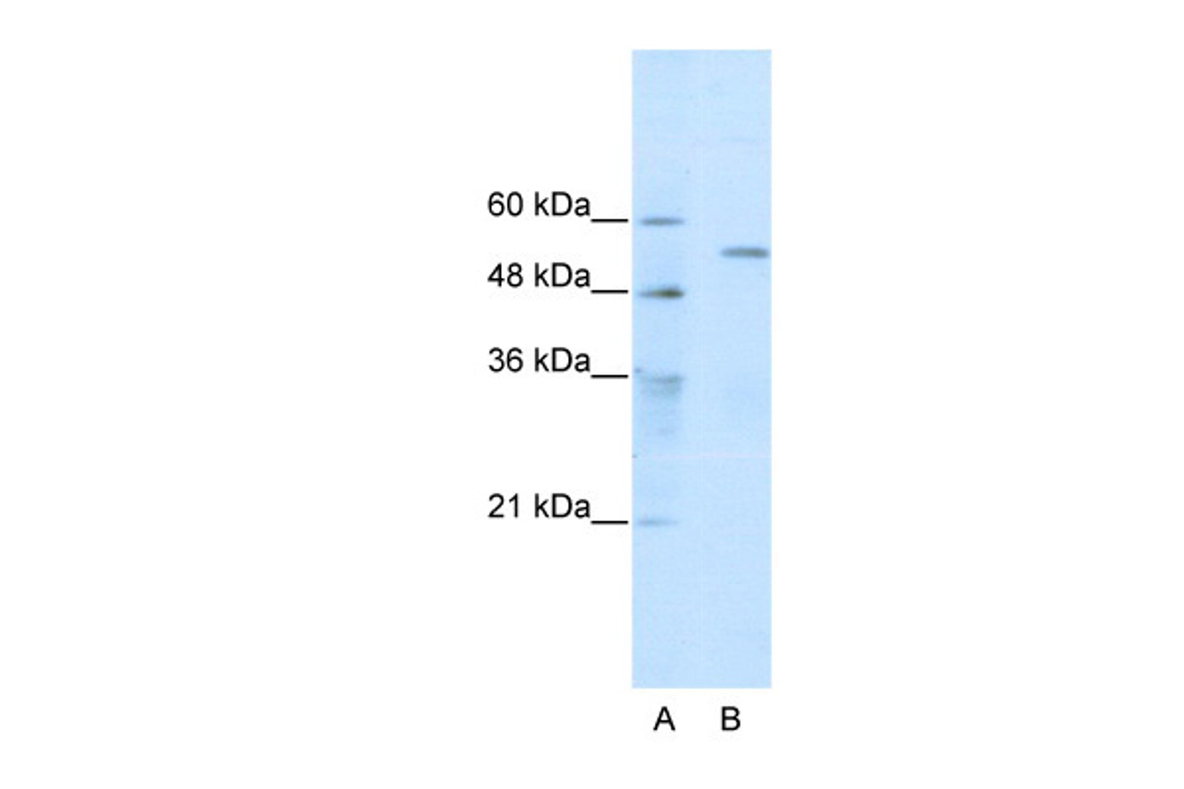 Antibody used in WB on Human HepG2 at 0.2-1 ug/ml.