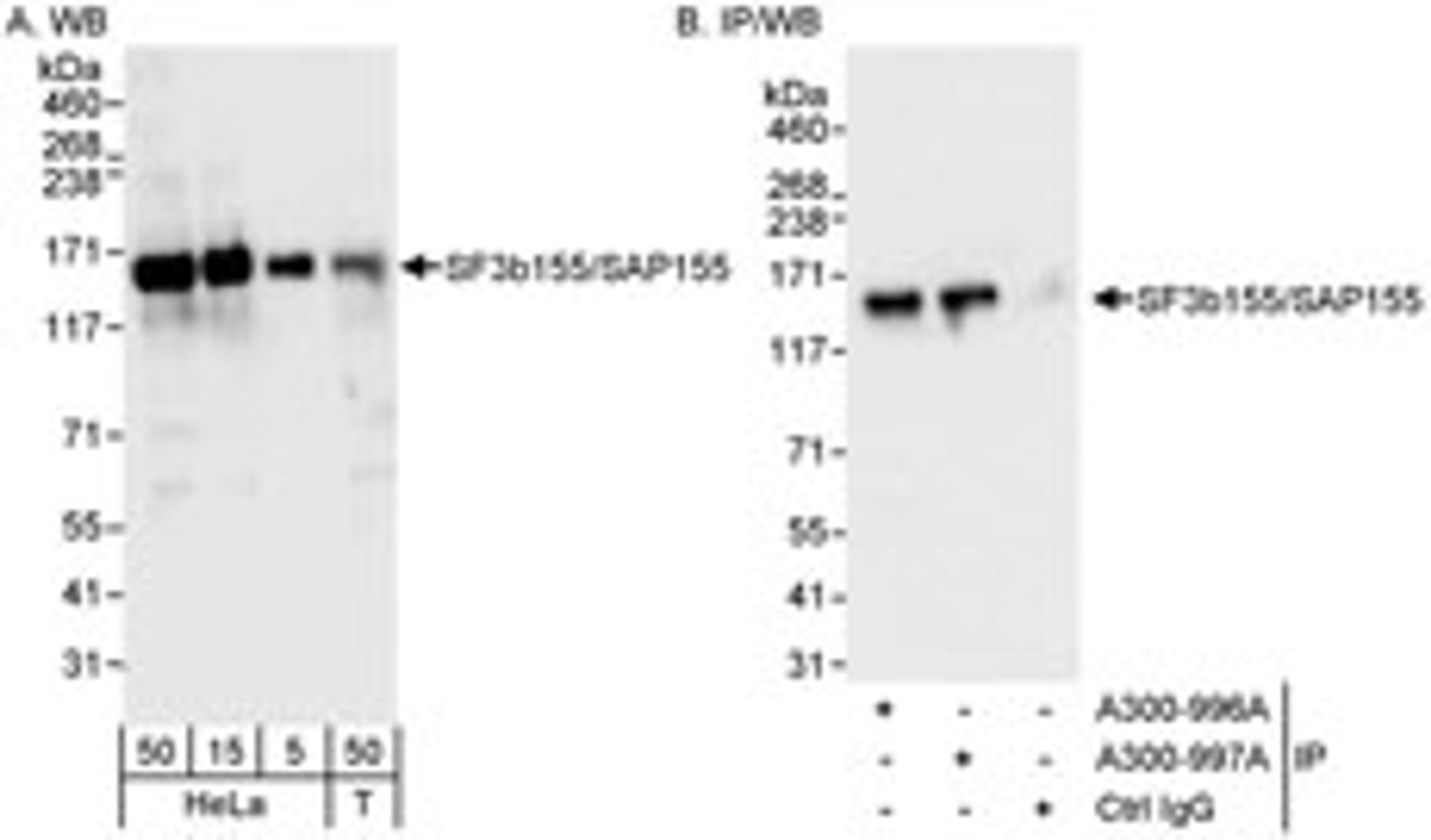 Detection of human SF3b155/SAP155 by western blot and immunoprecipitation.