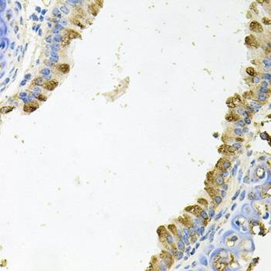 Immunohistochemical staining of mouse brain tissue using KLK11 antibody (dilution of 1:100)