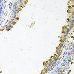 Immunohistochemical staining of mouse brain tissue using KLK11 antibody (dilution of 1:100)