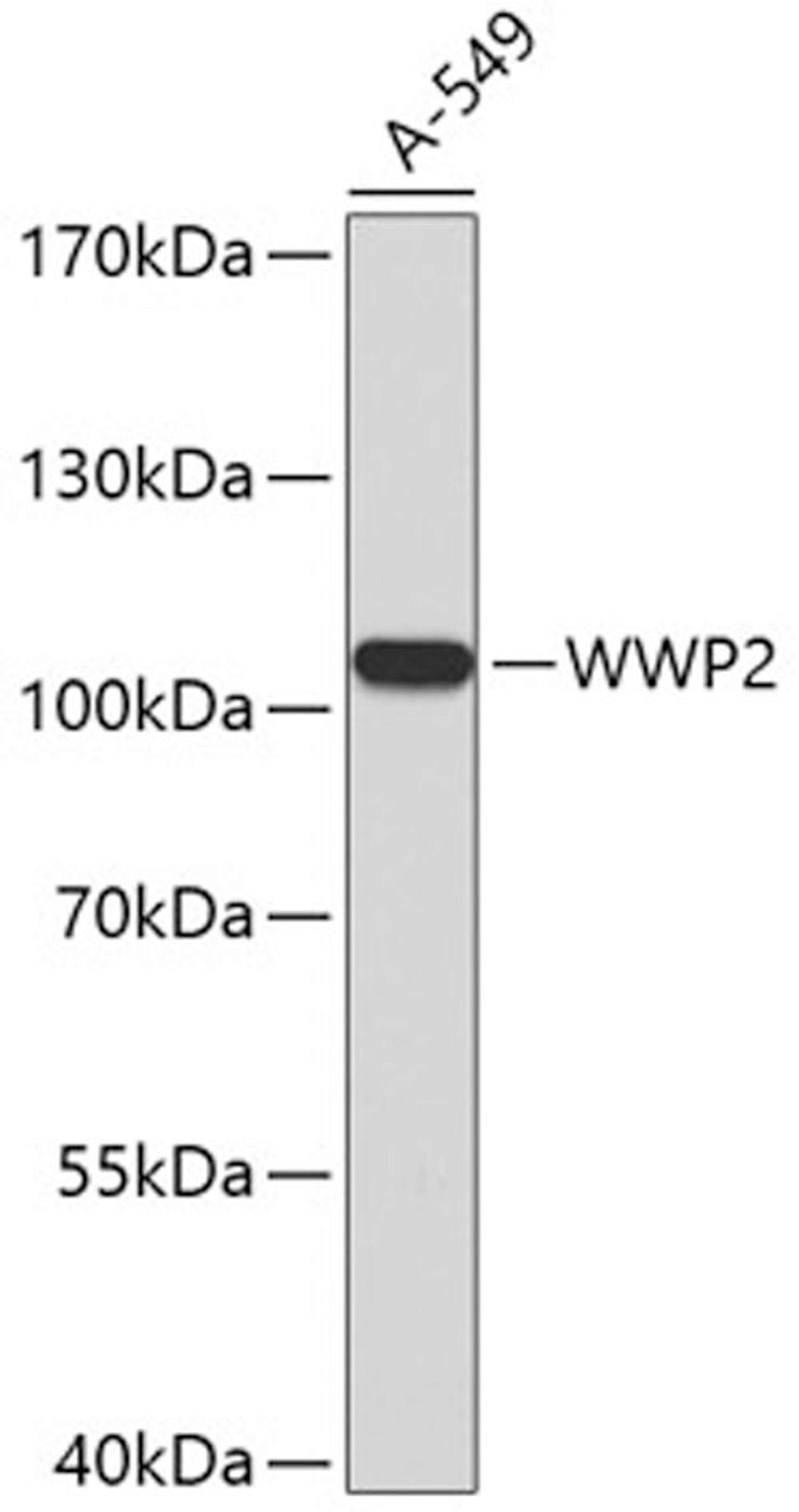 Western blot - WWP2 antibody (A2425)