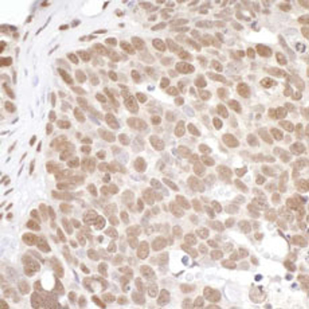 Detection of human PRMT1 by immunohistochemistry.