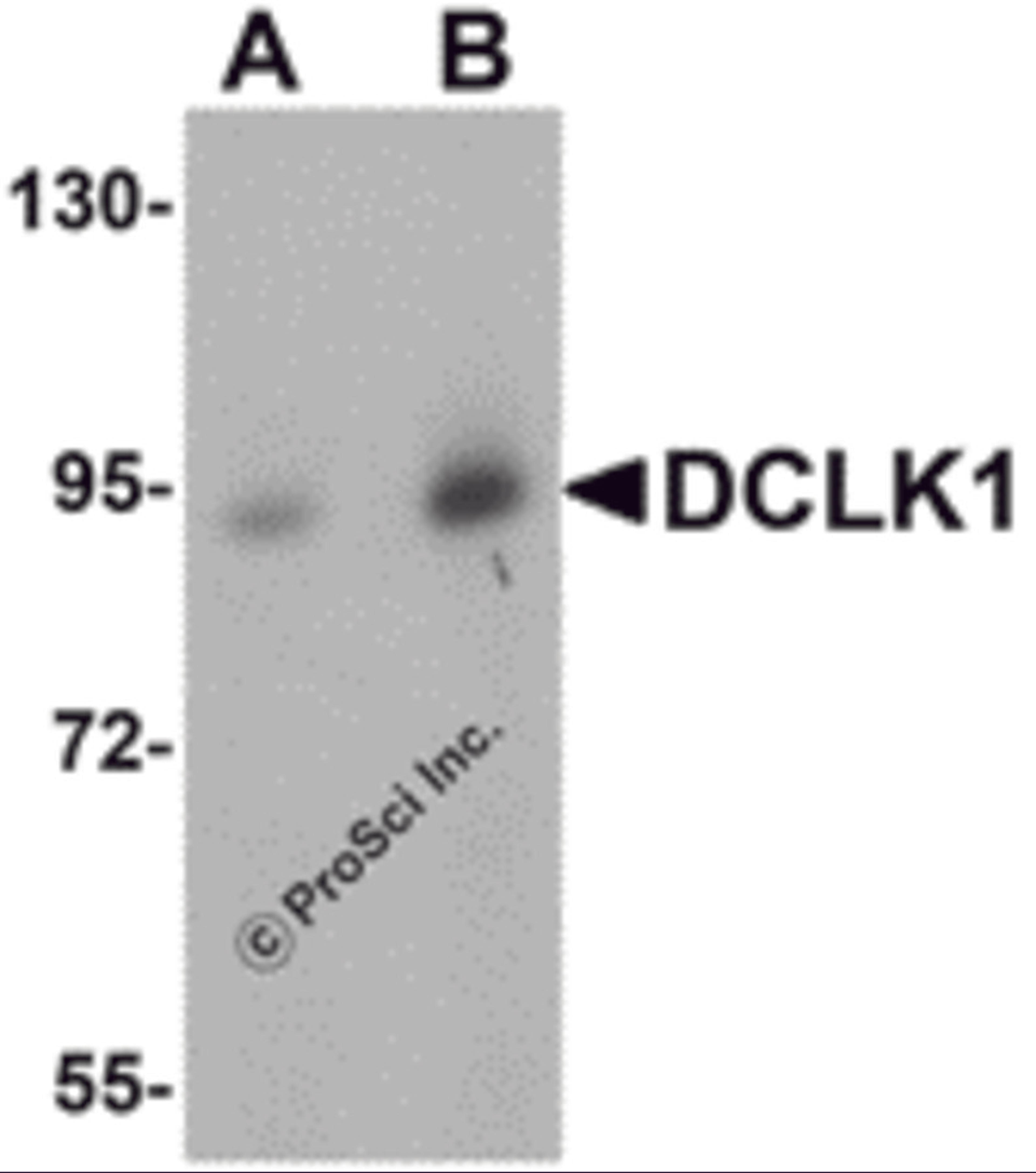 Western blot analysis of DCLK1 in human brain tissue lysate with DCLK1 antibody at (A) 0.5 and (B) 1 &#956;g/mL.