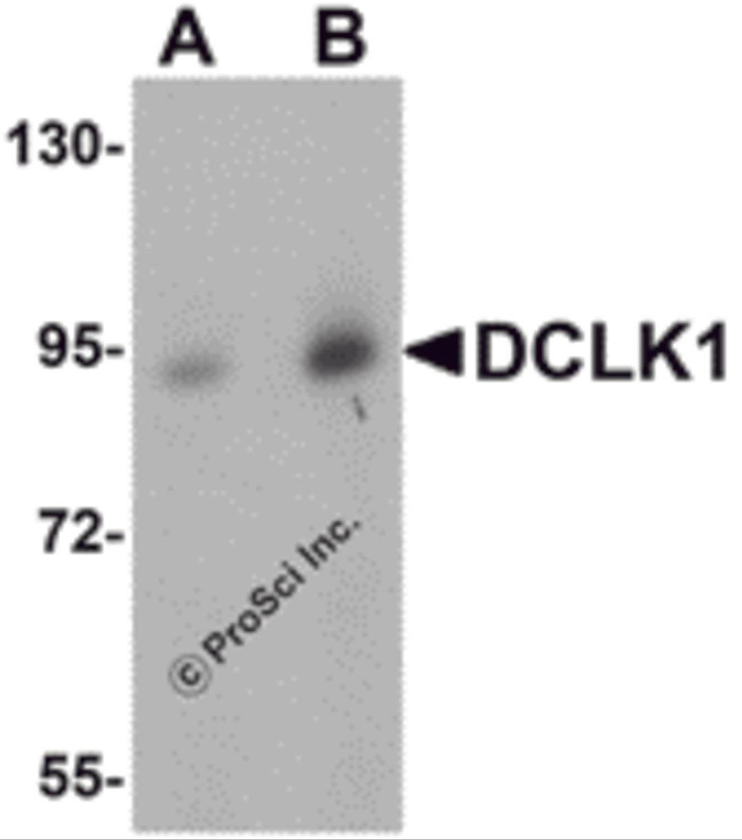 Western blot analysis of DCLK1 in human brain tissue lysate with DCLK1 antibody at (A) 0.5 and (B) 1 μg/mL.